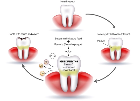 Dental Health